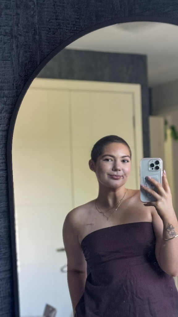 Annalise during cancer treatment. 