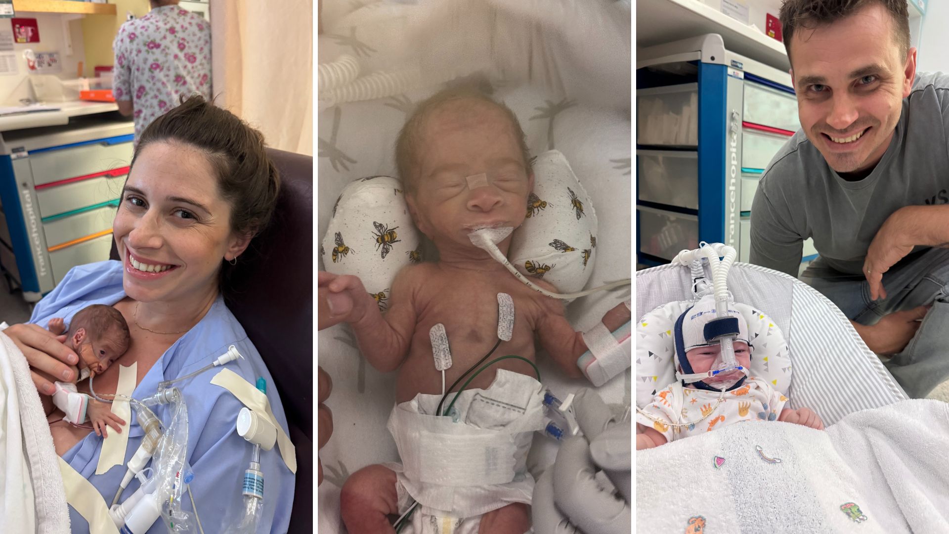 Harland was born the size of a 24-week-old premature baby.