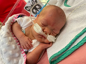 Tillie photographed at 100 days post birth sleeping in a cot. There is a blanket over her and oxygen tubes in her nostrils.