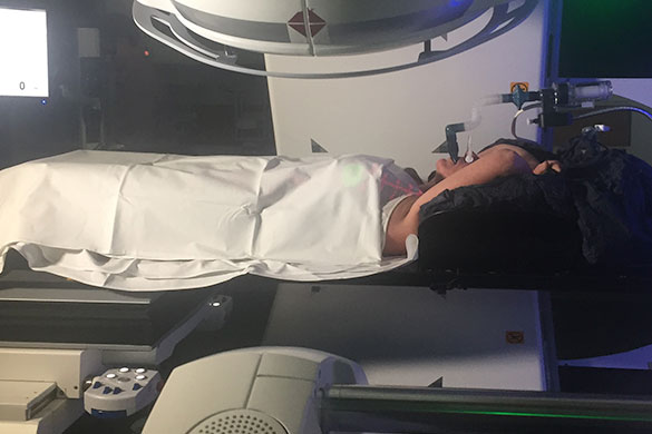 Patient Claire Holland undergoing treatment using the DIBH equipment at GCUH. Patient Claire Holland undergoing treatment using the DIBH equipment at GCUH.